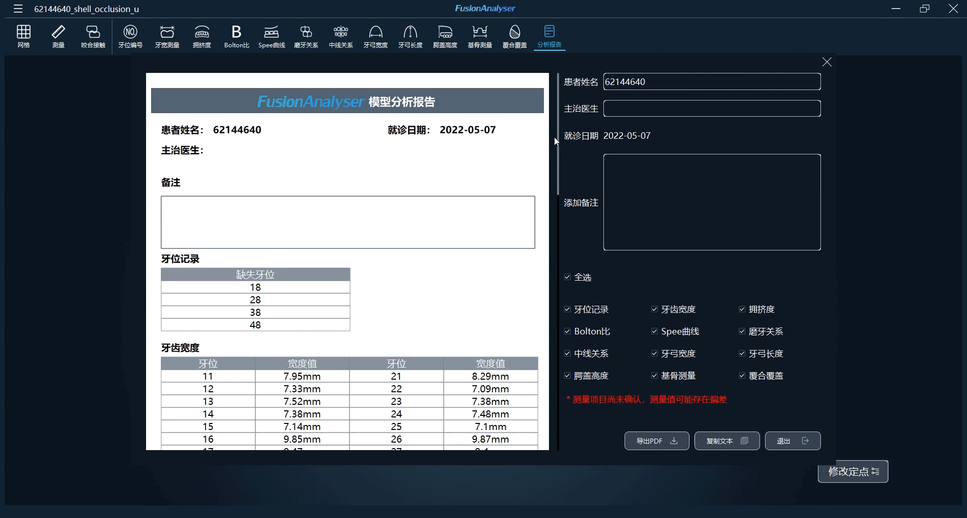 FusionAnalyser模型分析软件