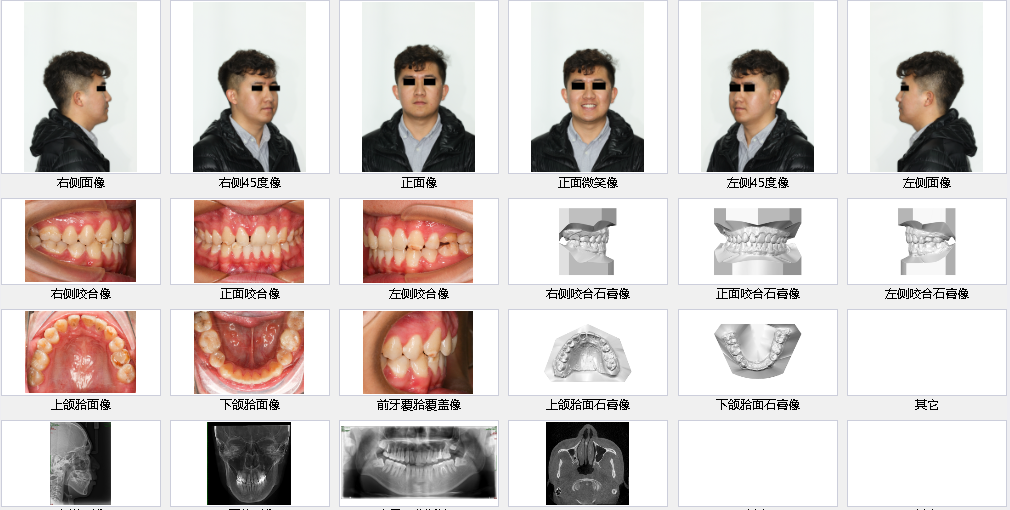 CephNEX正畸软件丨专业便捷