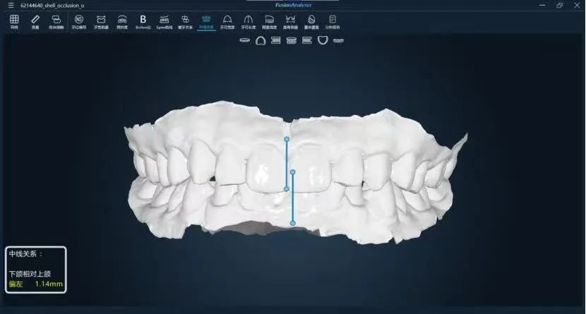 FusionAnalyser | 教你三步玩转模型测量！（下）