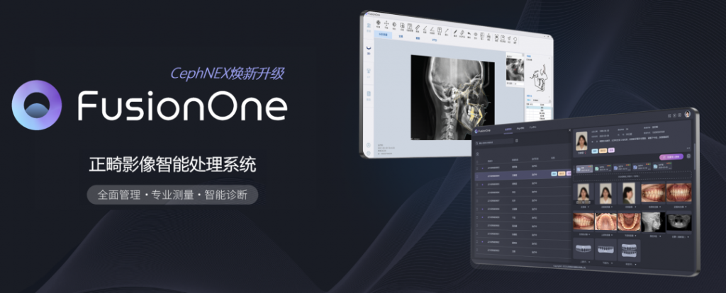 新品预告 | FusionOne正畸影像智能处理系统 即将上线
