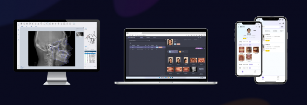 新品预告 | FusionOne正畸影像智能处理系统 即将上线