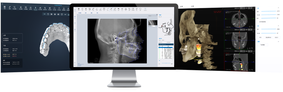 新品预告 | FusionOne正畸影像智能处理系统 即将上线