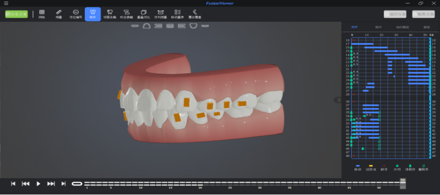 焕新升级| FusionViewer正畸方案查看器新版发布