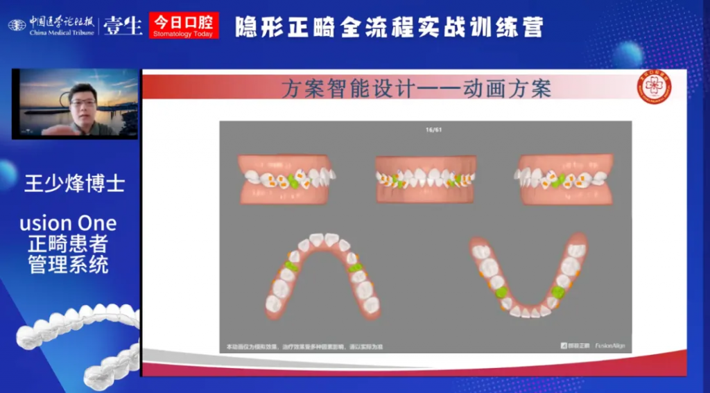 朗视正畸数字化软件，赋能隐形正畸实战训练营教学与临床应用